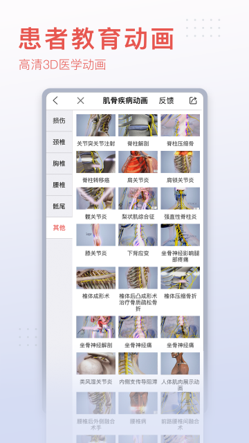 3DBody解剖介绍图